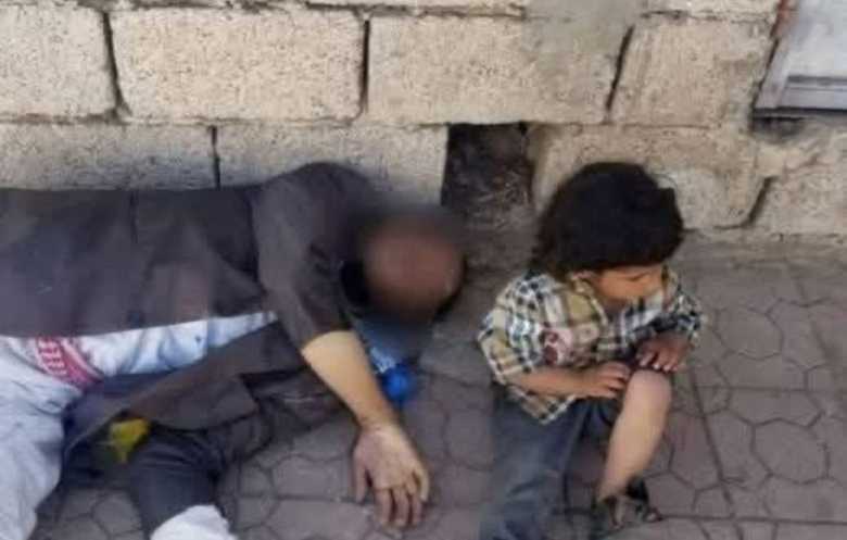 الحوثيون يدفنون آثار رجل مات جوعا بجوار طفله