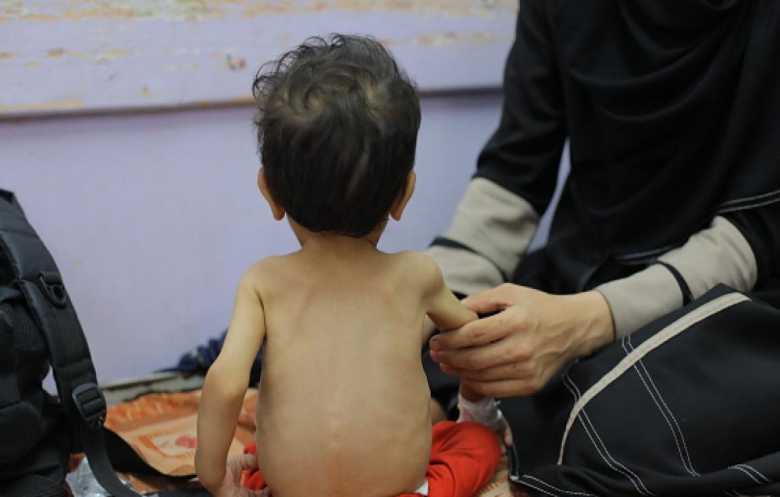 دعوات دولية لوقف حرب غزة بعد إعلان المجاعة: وصمة عار وفضيحة أخلاقية