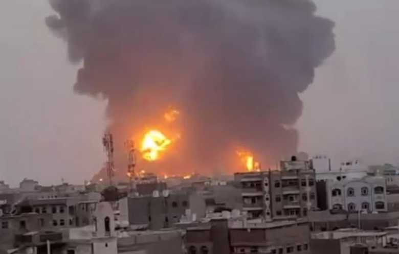 الغارات على اليمن أضرت بالبنى التحتية الصحية وأدت لانتشار أسوأ حالات كوليرا في العالم