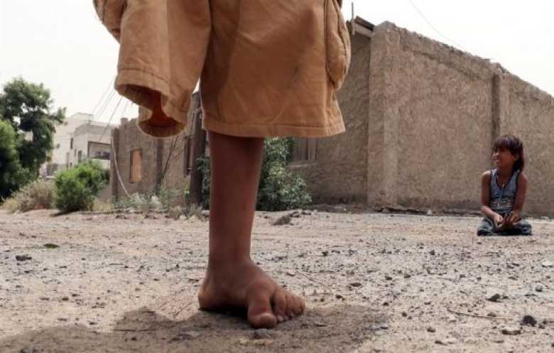 أكثر من 3 آلاف طفل ضحايا الأسلحة المتفجرة في اليمن خلال 5 سنوات