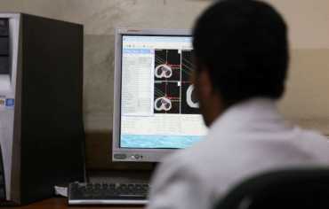 دراسة تحذر من زيادة مخاطر الإصابة بالسرطان بالنسبة لمن لم يسبق لهم الزواج