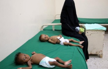  الموت جوعاً... الأزمة الإنسانية المنسية لأطفال اليمن